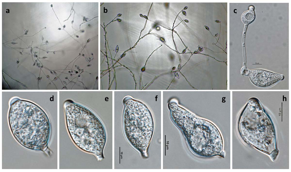 phytophthora infestans microscope