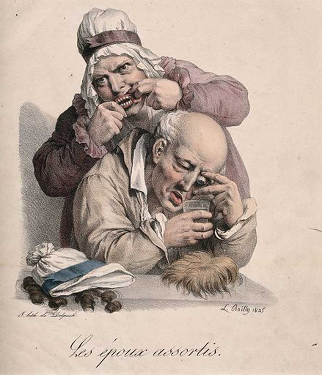 couple assembles false body parts