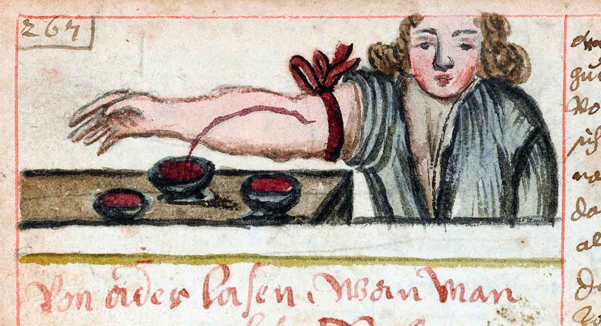 bloodletting manuscript image