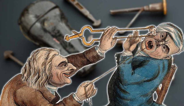 llustration of historical tooth extraction