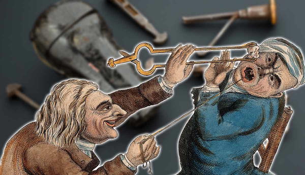 llustration of historical tooth extraction