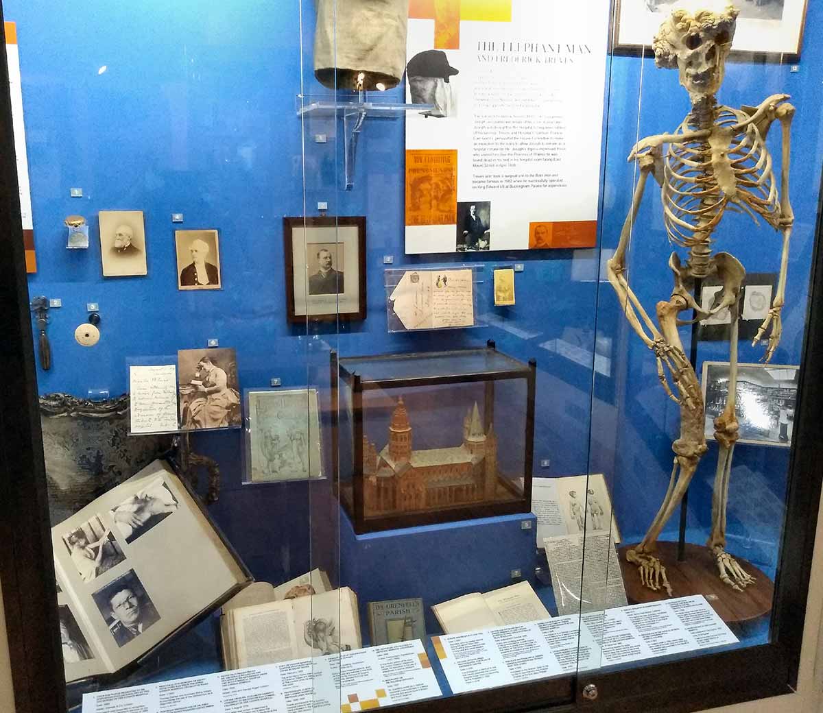 joseph merrick skeleton