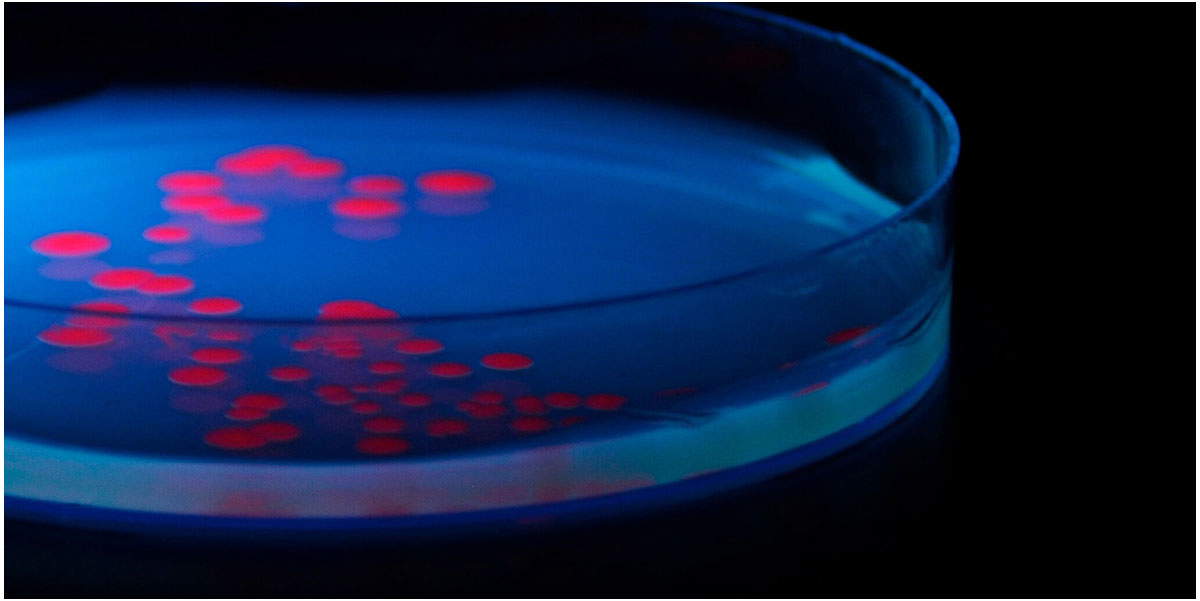 ecoli petri dish