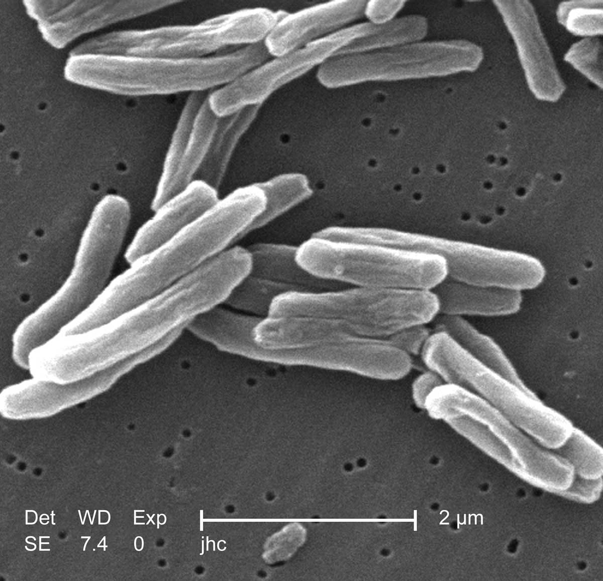 tuberculosis bacteria under microscope