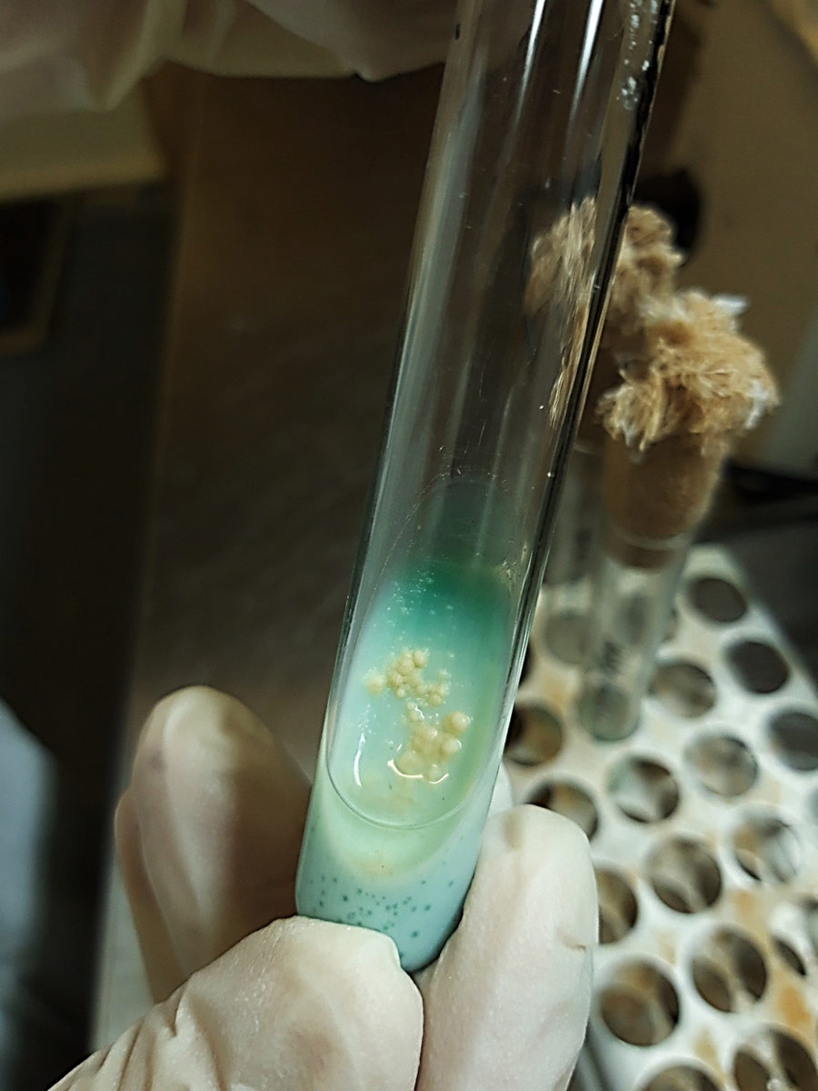 tuberculosis growing in lab medium
