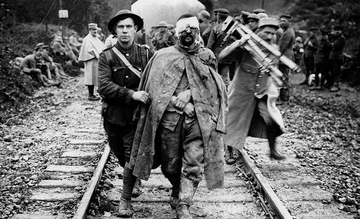 injured soldiers WWI