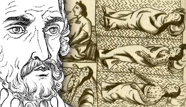 Man with sketch of historical Aztec smallpox outbreak.