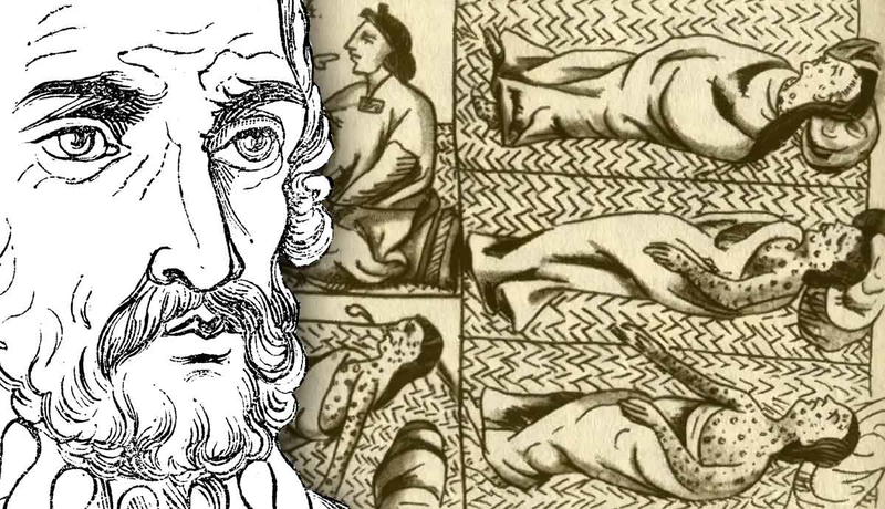 Man with sketch of historical Aztec smallpox outbreak.